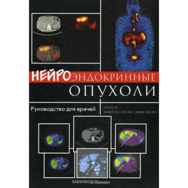 Нейроэндокринные опухоли: руководство для врачей. Под ред. Кэплин М., Кволс Л.