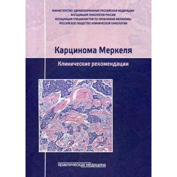 Карцинома Меркеля. Клинические рекомендации. Болотина Л.В. и др.