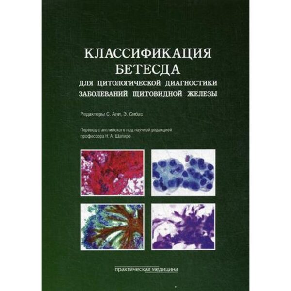 Классификация Бетесда для цитологической диагностики заболеваний щитовидной железы: терминология, критерии и пояснения