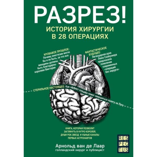 Разрез! История хирургии в 28 операциях. Ван де Лаар А.