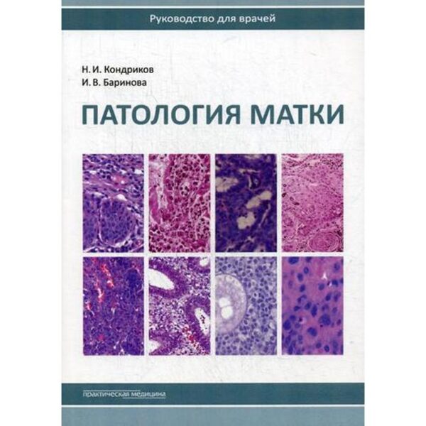 Патология матки. Руководство для врачей. 2-е издание. Кондриков Н. И., Баринова И. В.