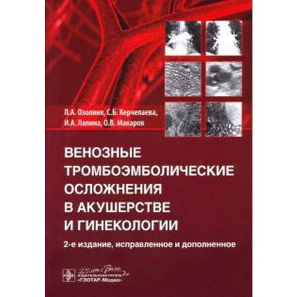 Венозные тромбоэмболические осложнения в акушерстве. Озолиня Л.А., Керчелаева С.Б., Лапина И.А.