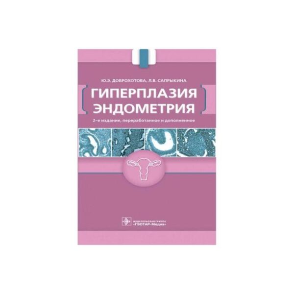 Гиперплазия эндометрия. Доброхотова Ю.