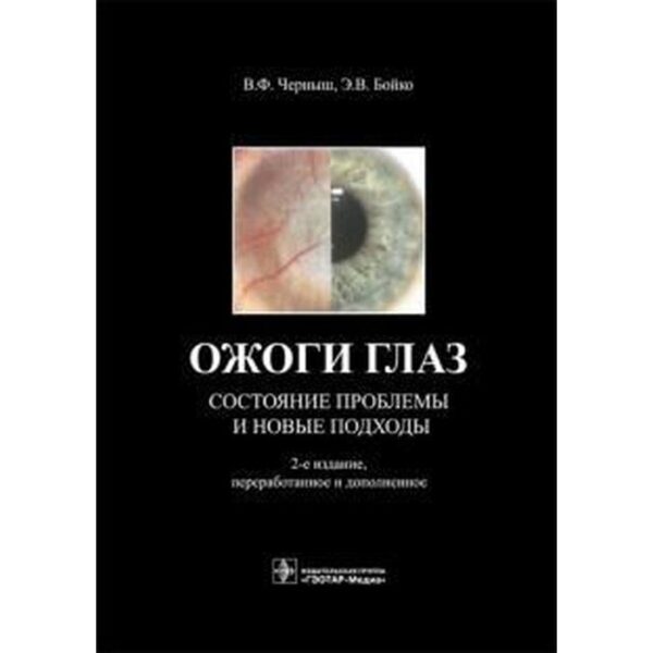 Ожоги глаз. Состояние проблемы и новые подходы