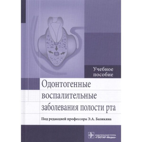 Одонтогенные восполительные заболевания полости рта