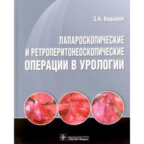 Лапароскопические и ретроперитонеоскопические операции в урологии