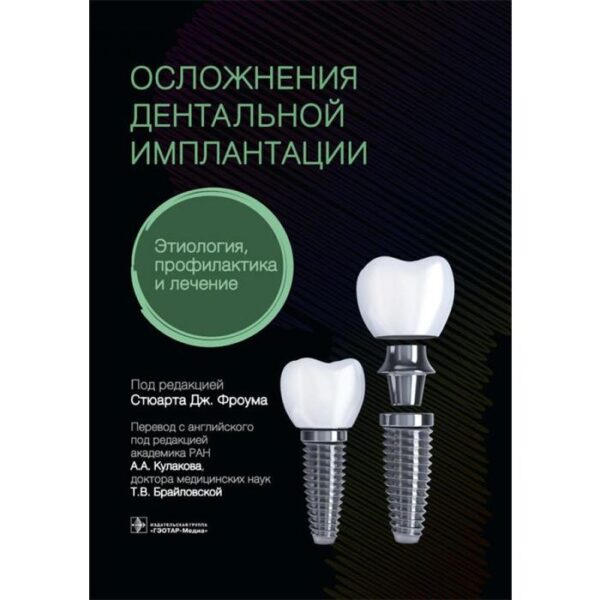 Осложнения дентальной имплантации. Этиология, профилактика и лечение под редакцией Фроума