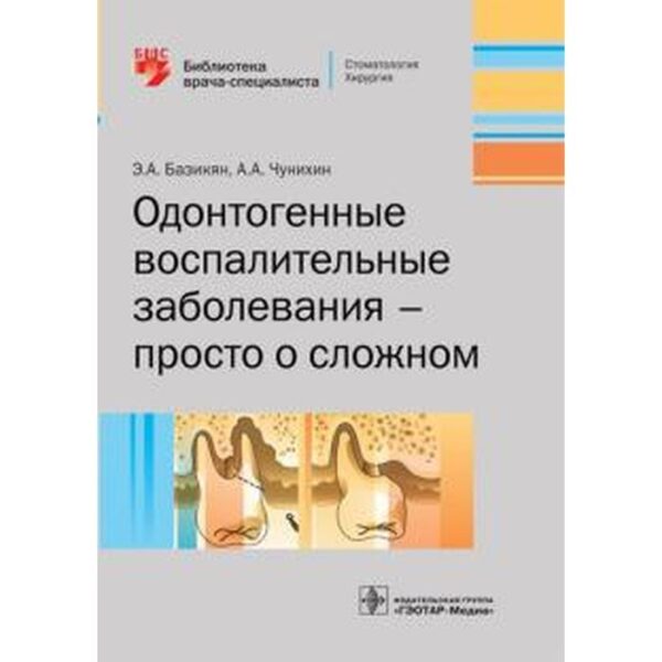 Одонтогенные воспалительные заболевания — просто о сложном