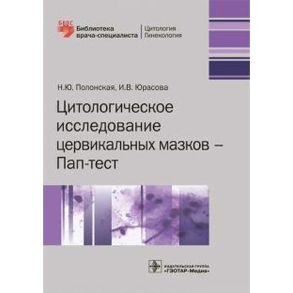 Цитологическое исследование церквиальных мазков-Пап-тест