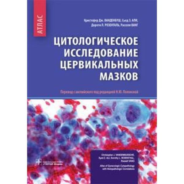 Цитологическое исследование цервикальных мазков