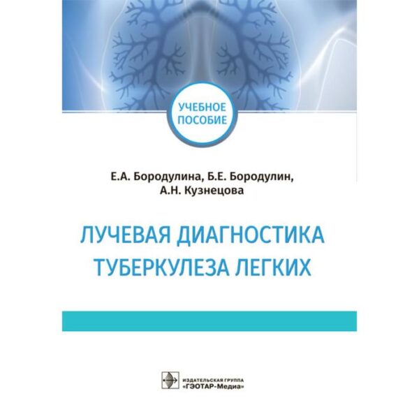 Лучевая диагностика туберкулеза легких. Бородулина Е., Бородулин Б., Кузнецова А.