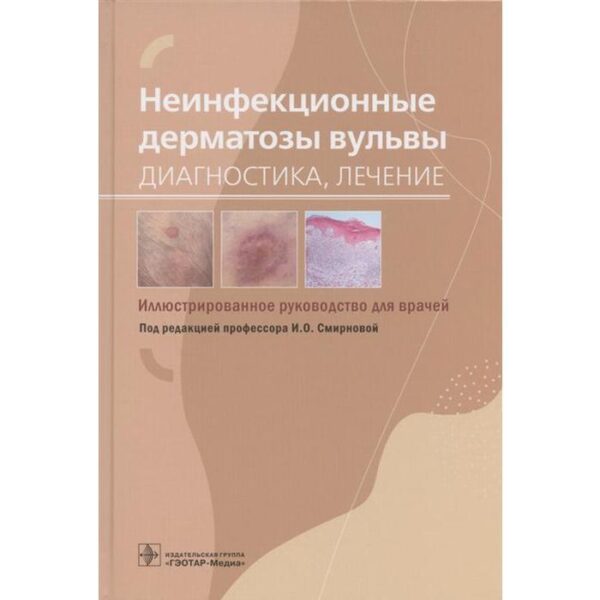 Неинфекционные дерматозы вульвы. Диагностика, лечение. Иллюстрир. руководство для врачей. Под редакцией И.О. Смирновой