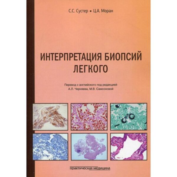 Интерпретация биопсий легкого. Сустер С. С., Моран Ц. А.