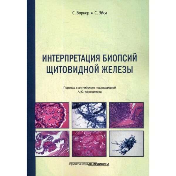 Интерпретация биопсий щитовидной железы. Борнер С., Эйса С.