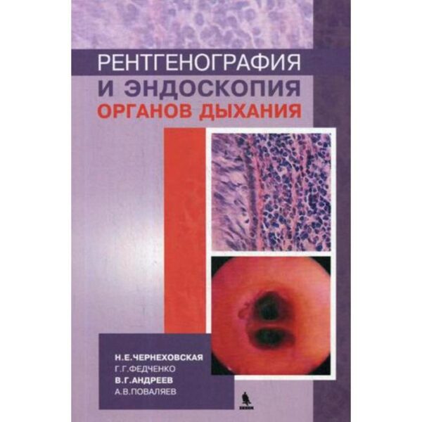 Рентгенография и эндоскопия органов дыхания: Учебное пособие. Чернеховская Н.Е.