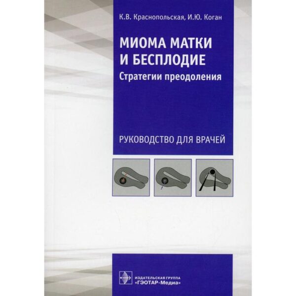 Миома матки и бесплодие: стратегии преодоления. Краснопольская К.В., Коган И.Ю.