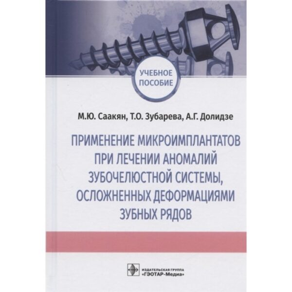 Применение микроимплантатов при лечении аномалий зубочелюстной системы, осложнённых деформациям зубных рядов. Саакян М., Зубарева Т., Долидзе А.