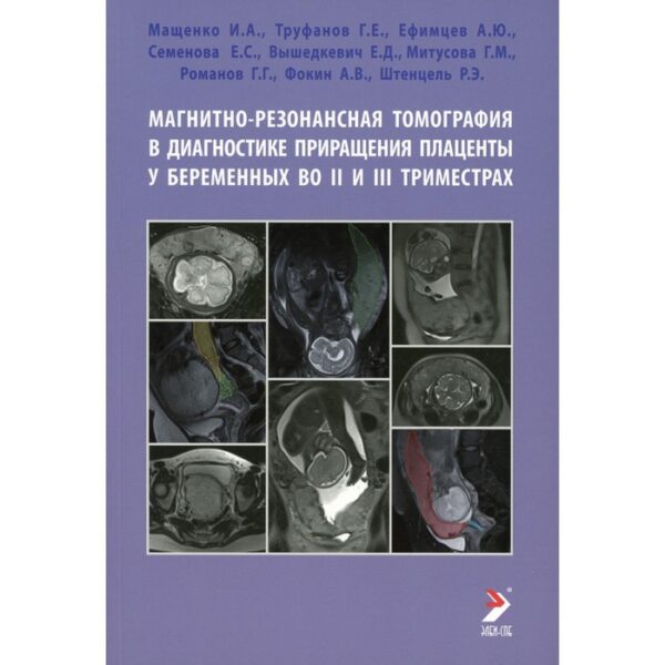 Магнитно-резонансная томография в диагностике приращения плаценты у беременных во II и III триместра. Мащенко И.А., Труфанов Г.Е., Ефимцев А.Ю., Семенова Е.С., Вышедкевич Е.Д., Митусова Г.М. и другие