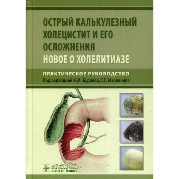 Острый калькулезный холецистит и его осложнения. Новое о холелитиазе. Практическое руководство