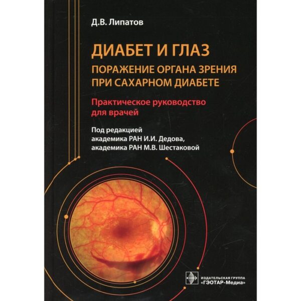 Диабет и глаз. Поражение органа зрения при сахарном диабете. Липатов Д.В.