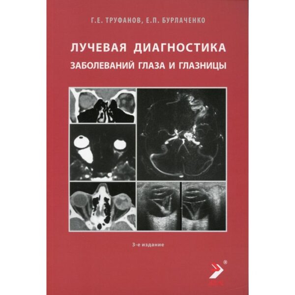 Лучевая диагностика заболеваний глаза и глазницы. 3-е издание. Труфанов Г.Е., Бурлаченко Е.П.