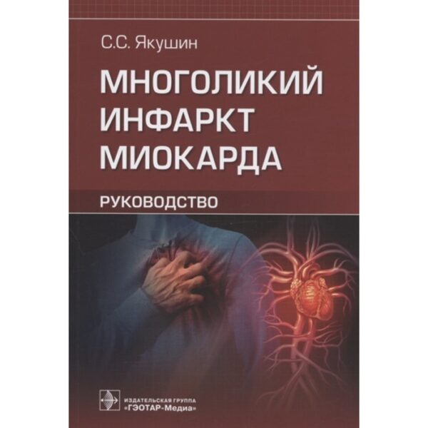 Многоликий инфаркт миокарда: руководство. Якушин Сергей Степанович