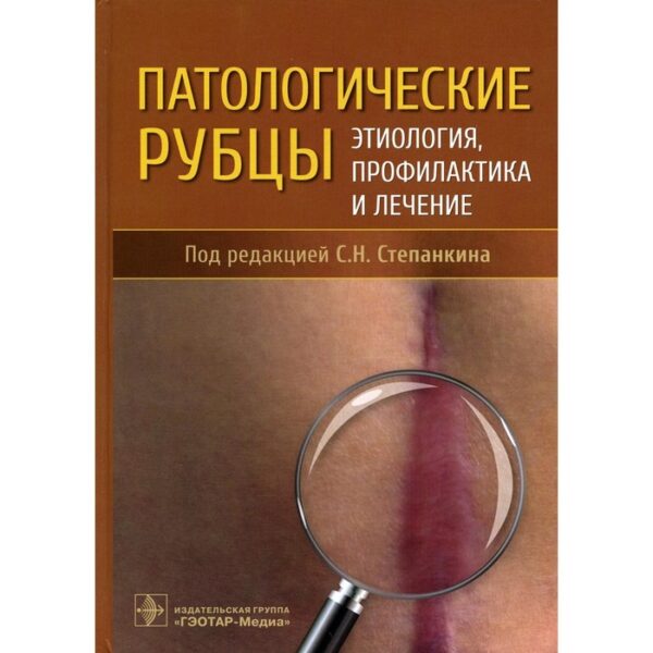 Патологические рубцы. Этиология, профилактика и лечение