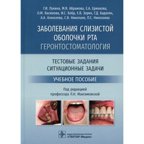 Заболевания слизистой оболочки рта. Геронтостоматология. Тестовые задания, ситуационные задачи