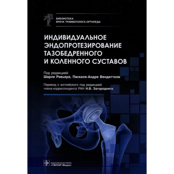 Индивидуальное эндопротезирование тазобедренного и коленного суставов