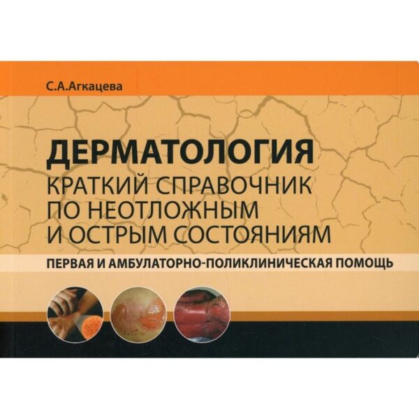 Дерматология. Первая и амбулаторно-поликлиническая помощь. Агкацева С.А.